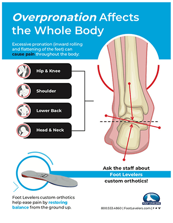 Chiropractic Waukesha WI Overpronation Affects Whole Body